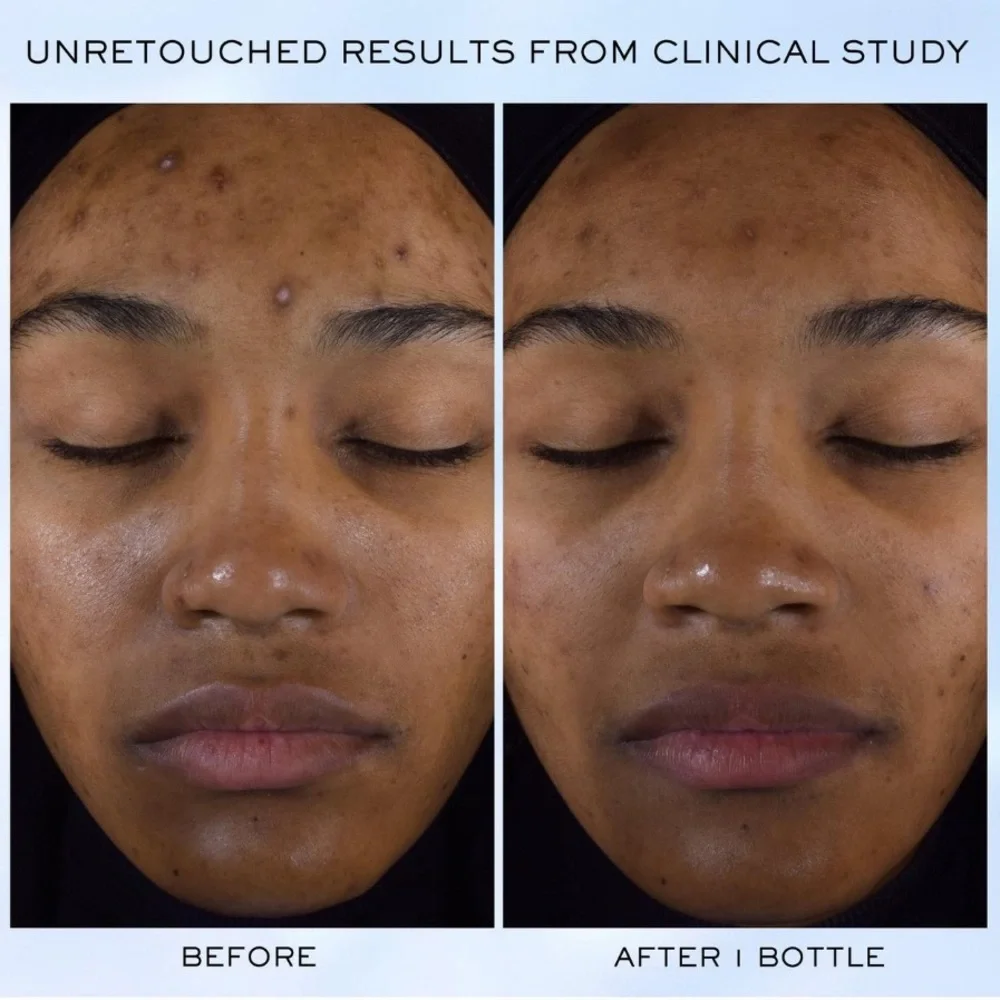 $13❤️‍🔥 Lancôme Clarifique Pro-Solution Brightening & Dark Spot Reducing Serum - Picture 6 of 12